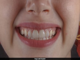 German Man Says Indians Have Good Dental Hygiene, Internet Divided German Man Says Indians Have Good Dental Hygiene, Internet Divided