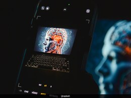 'Unemployment Could Rise Sharply': Jefferies Big Warning On AI