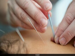 Chinese Man Hospitalised With Collapsed Lungs After Acupuncture Session Chinese Man Hospitalised With Collapsed Lungs After Acupuncture Session