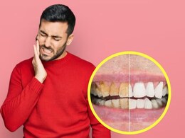 दांतों में ठंडा-गर्म लगता है? डॉक्टर ने बताया नारियल के तेल से रोज कर लें ये सस्ता उपाय, दांतों पर जमी पीली परत से भी मिल जाएगा छुटकारा