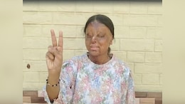 Chandigarh Teen Lost Eyes In Acid Attack, Scores 95.6% In Class 12 Boards