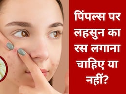 लहसुन के रस से क्या सचमुच कम होते हैं पिंपल्स? स्किन डॉक्टर ने किया खुलासा, घरेलू नुस्खों को लेकर दी यह सलाह  लहसुन के रस से क्या सचमुच कम होते हैं पिंपल्स? स्किन डॉक्टर ने किया खुलासा, घरेलू नुस्खों को लेकर दी यह सलाह