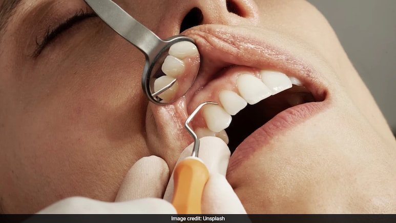 दांत चमकाने वाले सोशल मीडिया वायरल हैक पर एक्सपर्ट्स की चेतावनी! आंख मूंद कर ना आजमाएं वरना झड़ जाएंगे सारे