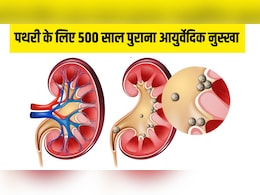 पथरी को जड़ से खत्म कर सकता है ये 500 साल पुराना आयुर्वेदिक नुस्खा, न्यूट्रिशनिस्ट ने बताया बस रोज पी लें ये खास ड्रिंक पथरी को जड़ से खत्म कर सकता है ये 500 साल पुराना आयुर्वेदिक नुस्खा, न्यूट्रिशनिस्ट ने बताया बस रोज पी लें ये खास ड्रिंक