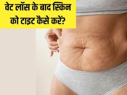 Weight Loss करने के बाद लटकी स्किन को टाइट कैसे करें? यहां जान लें असरदार तरीके Weight Loss करने के बाद लटकी स्किन को टाइट कैसे करें? यहां जान लें असरदार तरीके