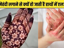 मेहंदी लगाते ही हाथों में हो जाती है एलर्जी? डॉक्टर ने बताया क्यों होता है ऐसा, इस ट्रिक से कभी नहीं होगी जलन और खुजली मेहंदी लगाते ही हाथों में हो जाती है एलर्जी? डॉक्टर ने बताया क्यों होता है ऐसा, इस ट्रिक से कभी नहीं होगी जलन और खुजली