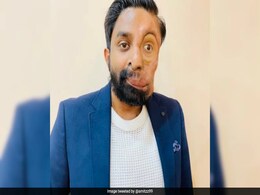 Indian-Origin Man Claims London Cafe Refused Him Service Because Of His Face: "Everyone Was Staring At Me" Indian-Origin Man Claims London Cafe Refused Him Service Because Of His Face: "Everyone Was Staring At Me"
