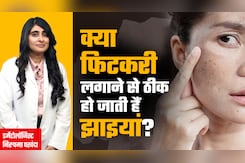 क्या वाकई फिटकरी लगाने से झाइयां ठीक हो जाती हैं? क्या वाकई फिटकरी लगाने से झाइयां ठीक हो जाती हैं?