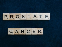 How A Specific Antigen Blood Test Alone Can&#039;t Confirm Prostate Cancer