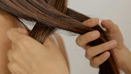 Did You Know? These Everyday Foods Might Be Contributing To Hair Loss