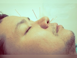 Facial acupuncture क्या है? जानिए कैसे ये छोटी सी सुई है कई स्वास्थ्य समस्याओं का समाधान