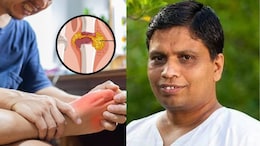 Acharya Balkrishna यांनी वाढलेल्या Uric Acid वर सांगितला उपाय, या जादुई औषधामुळे शरीर होईल डिटॉक्स