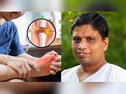 Acharya Balkrishna ने बताया बढ़े हुए Uric Acid का इलाज, इस 'चमत्कारी औषधि' से हो जाएगा टॉक्सिन का सफाया, बुढ़ापे में भी मजबूत रहेंगे जोड़ Acharya Balkrishna ने बताया बढ़े हुए Uric Acid का इलाज, इस 'चमत्कारी औषधि' से हो जाएगा टॉक्सिन का सफाया, बुढ़ापे में भी मजबूत रहेंगे जोड़