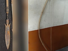 Cop Attacked With Bow And Arrow In Lucknow, Lands In Hospital