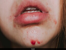 Harvard-Trained Dermatologist Warns: Early Signs Of Skin Cancer You Must Watch For Harvard-Trained Dermatologist Warns: Early Signs Of Skin Cancer You Must Watch For