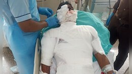 मॉक ड्रिल के वक्त फटा हैंड ग्रेनेड, दो पुलिसकर्मी घायल; भोपाल की 25वीं बटालियन में बड़ा हादसा