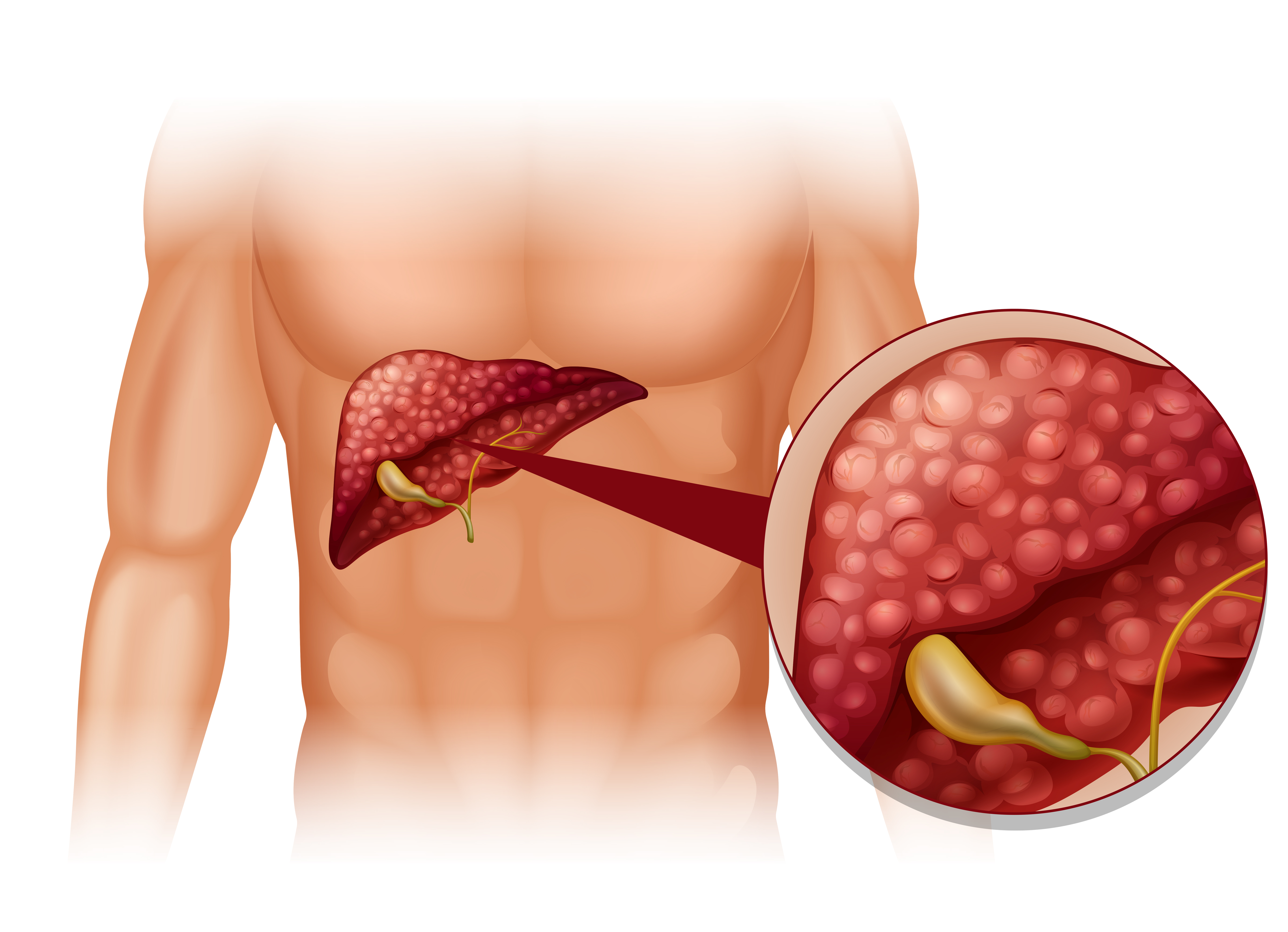 Alcohol can have a detrimental effect on the liver