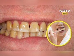 Teeth Whitening: मोत्यासारखे चकचकीत दात करायचेत?  मग 'या' 2 गोष्टी नक्की करा