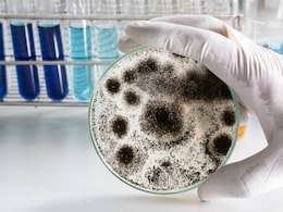 Aspergillus: The Fungi That Can Eat Humans 'Inside Out', Spark A Pandemic Aspergillus: The Fungi That Can Eat Humans 'Inside Out', Spark A Pandemic
