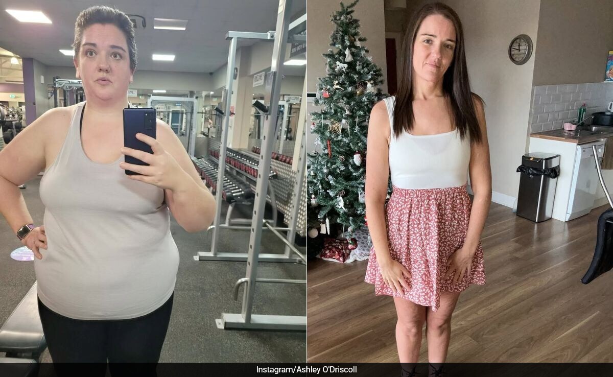 Irish Woman Lost Half Her Weight On Ozempic Here s What Happened After