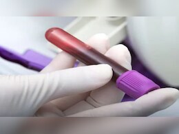 नया ब्लड टेस्ट बच्चों में हजारों दुर्लभ आनुवंशिक बीमारियों की जल्दी पहचान करेगा, शोध में नया खुलासा   नया ब्लड टेस्ट बच्चों में हजारों दुर्लभ आनुवंशिक बीमारियों की जल्दी पहचान करेगा, शोध में नया खुलासा