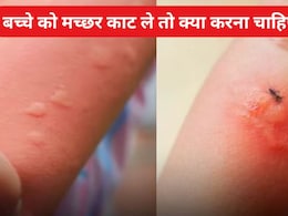 बच्चे को मच्छर काट ले तो क्या करना चाहिए? बच्चों के डॉक्टर ने दी माता-पिता को सलाह  बच्चे को मच्छर काट ले तो क्या करना चाहिए? बच्चों के डॉक्टर ने दी माता-पिता को सलाह