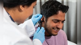 How To Remove Earwax: कानातील मळ काढण्यासाठी डॉक्टरांनी सांगितले सोपे उपाय, चुंबकाप्रमाणे बाहेर येईल घाण