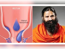 बवासीर की समस्या को 3-7 दिनों में जड़ से खत्म करेगा ये हरा पत्ता, बाबा रामदेव ने बताया रामबाण नुस्खा बवासीर की समस्या को 3-7 दिनों में जड़ से खत्म करेगा ये हरा पत्ता, बाबा रामदेव ने बताया रामबाण नुस्खा