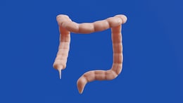 What You Eat Can Hurt Your Appendix. A List Of Foods What To Avoid