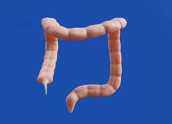 What You Eat Can Hurt Your Appendix. A List Of Foods What To Avoid What You Eat Can Hurt Your Appendix. A List Of Foods What To Avoid