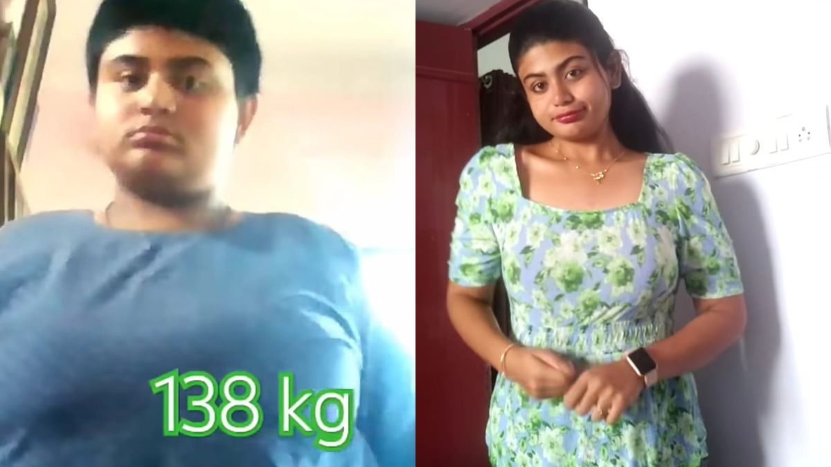 Viral Weight Loss Story: Woman Loses 63 Kg In 14 Months, Shares Diet Tips