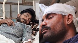 बूंदी: ढाबे पर बिल को लेकर हुआ बवाल, ASI और कांस्टेबल के साथ मारपीट; गंभीर घायल