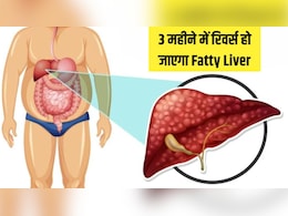 फैटी लीवर से क्‍या परेशानी होती है? जान गए तो तुरंत खाना छोड़ देंगे ये जहरीली चीजें
