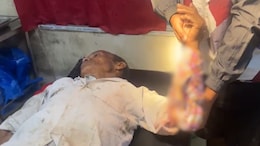Meitei Farmer Injured In Shooting By Suspected "Kuki Insurgents", Kuki Woman Killed In Crossfire With Security Forces