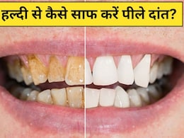 हल्दी से कैसे साफ करें पीले दांत? Dr. Hansaji Yogendra ने बताया इन 2 तरीकों से साफ हो जाएगी दांतों की पीली परत, मोती जैसे दिखेंगे Teeth हल्दी से कैसे साफ करें पीले दांत? Dr. Hansaji Yogendra ने बताया इन 2 तरीकों से साफ हो जाएगी दांतों की पीली परत, मोती जैसे दिखेंगे Teeth