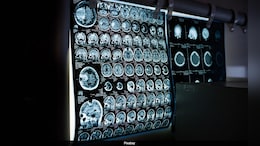 Doctors Remove Tumour From Woman's Brain As She Watches Pawan Kalyan Film