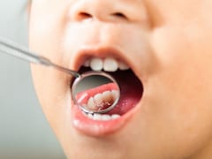 The Hidden Link Between Cavities And Overall Health: Expert Decodes
