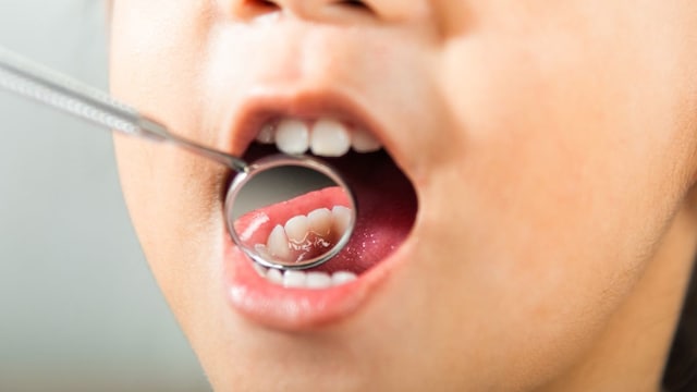 Your teeth don't just support your smile they tell the story of your health