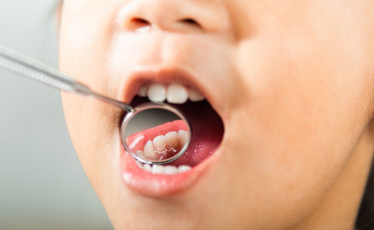 Your teeth don't just support your smile they tell the story of your health