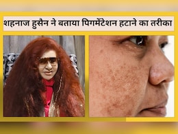 ब्यूटी एक्सपर्ट शहनाज हुसैन ने बताया पिगमेंटेशन 15 दिन में हो जाएगी दूर, घर में मौजूद ये चीजें करें इस्तेमाल ब्यूटी एक्सपर्ट शहनाज हुसैन ने बताया पिगमेंटेशन 15 दिन में हो जाएगी दूर, घर में मौजूद ये चीजें करें इस्तेमाल