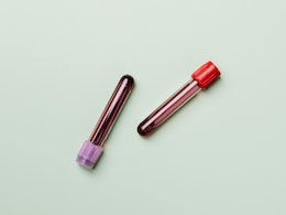 Universal Artificial Blood For All Types In Clinical Trials, Could Save Millions Universal Artificial Blood For All Types In Clinical Trials, Could Save Millions