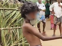 10-Year-Old Accused Of Stealing Cellphone, Tortured, In Andhra Pradesh 10-Year-Old Accused Of Stealing Cellphone, Tortured, In Andhra Pradesh