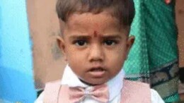 UP Man Throws Axe At Monkeys, It Slashes His Two-Year-Old Son's Neck