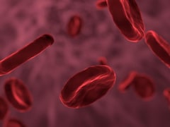 Indian Breakthrough In Bone Marrow Transplant To Aid Children With Sickle Cell Disease