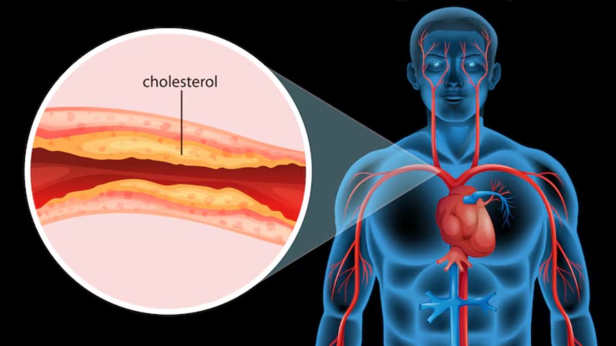 कोलेस्ट्रॉल कम करने के लिए क्या खाएं, ये हैं रामबाण उपाय | Cholesterol Kaise Kam Kare
