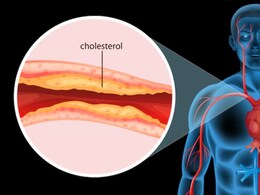 कोलेस्ट्रॉल कम करने के लिए क्या खाएं, ये हैं रामबाण उपाय | Cholesterol Kaise Kam Kare कोलेस्ट्रॉल कम करने के लिए क्या खाएं, ये हैं रामबाण उपाय | Cholesterol Kaise Kam Kare