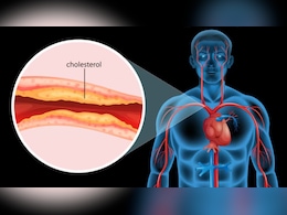 Bad Cholesterol का काल हैं रसोई में रखी ये 5 चीजें, डॉक्टर ने बताया रोज खाने से आर्टरीज नहीं होंगी ब्लॉक Bad Cholesterol का काल हैं रसोई में रखी ये 5 चीजें, डॉक्टर ने बताया रोज खाने से आर्टरीज नहीं होंगी ब्लॉक