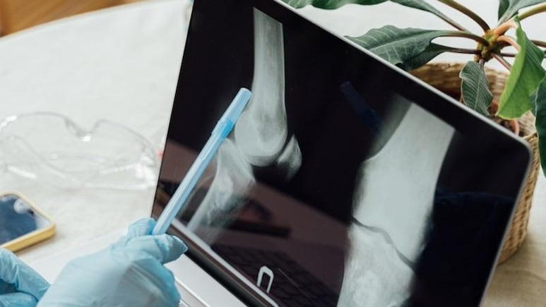 Rare Bone Cancer: Teen Recovers After Ventilator Support In Delhi