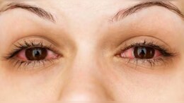 आंखों को स्वस्थ रखने के लिए अपनाएं ये आसान टिप्स, बढ़ेगी रोशनी