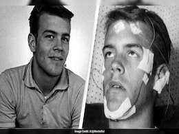 Man Who Did Not Sleep For 11 Days Reveals Its Impact On His Body Man Who Did Not Sleep For 11 Days Reveals Its Impact On His Body